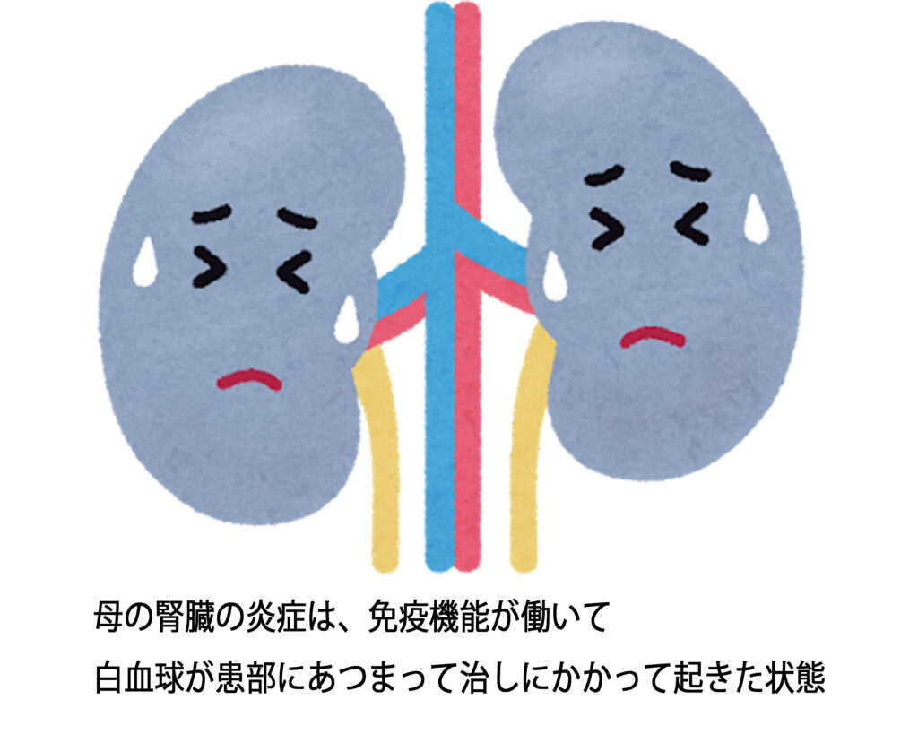 母の腎臓の炎症は、免疫機能が働いて白血球が患部に集まって治しにかかって起きた状態__肌質体質改善エステ_ビューラー大谷